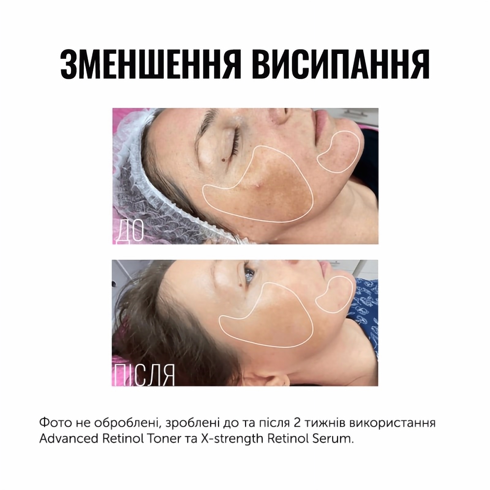 Instytutum Тонер з ретинолом ADVANCED RETINOL TONER