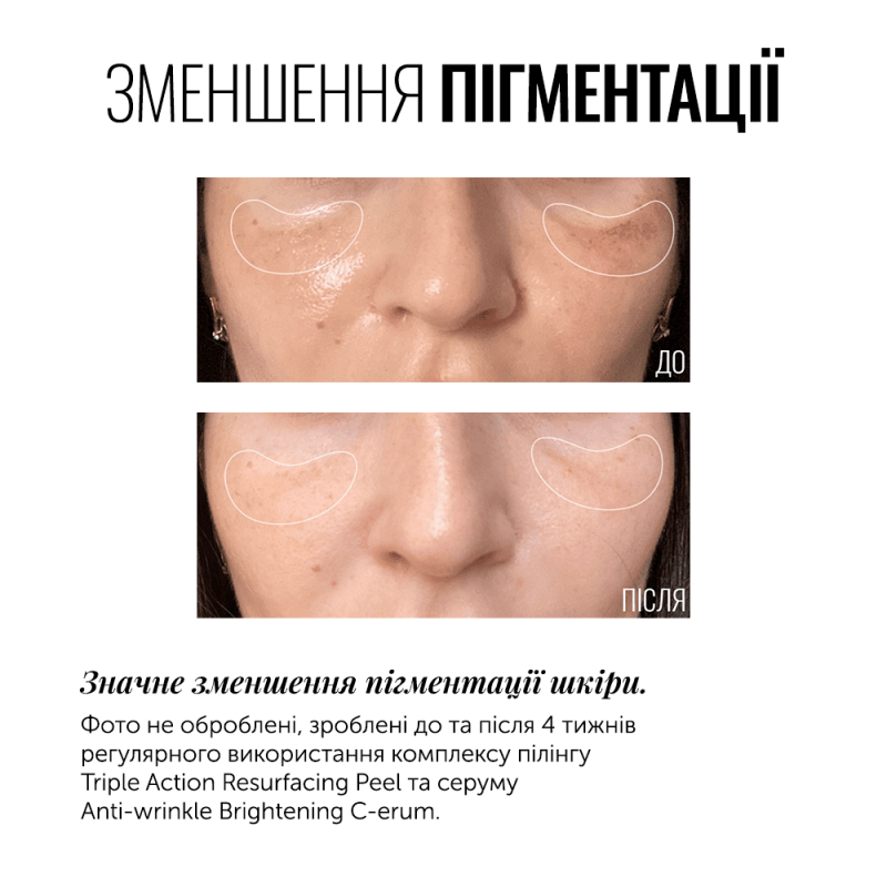 СИРОВАТКА З ВІТАМІНОМ С ANTI-WRINKLE BRIGHTENING C-ERUM