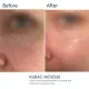 Делікатна пінка для вмивання BRADERM Kurac Mousse, 100 мл