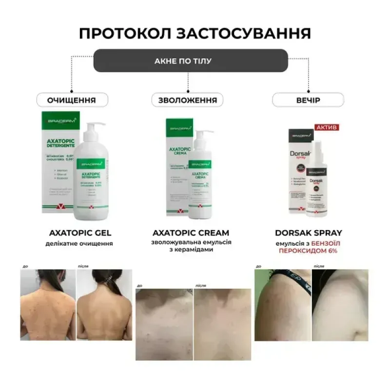 Протизапальний спрей-емульсія BRADERM Dorsak Spray, 100 мл