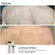 Протизапальний спрей-емульсія BRADERM Dorsak Spray, 100 мл