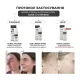 Протизапальний крем BRADERM Kurac Cream, 30 мл
