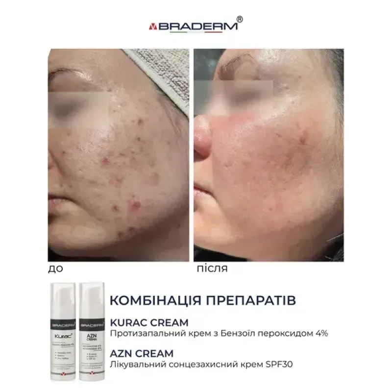 Протизапальний крем BRADERM Kurac Cream, 30 мл