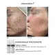 Протизапальний крем BRADERM Kurac Cream, 30 мл
