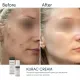 Протизапальний крем BRADERM Kurac Cream, 30 мл