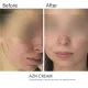Сонцезахисний протизапальний крем SPF30 BRADERM AZN Cream, 30 мл