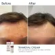 Освітлювальний крем BRADERM Tramexal Cream, 30 мл