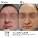 Освітлювальний крем BRADERM Tramexal Cream, 30 мл