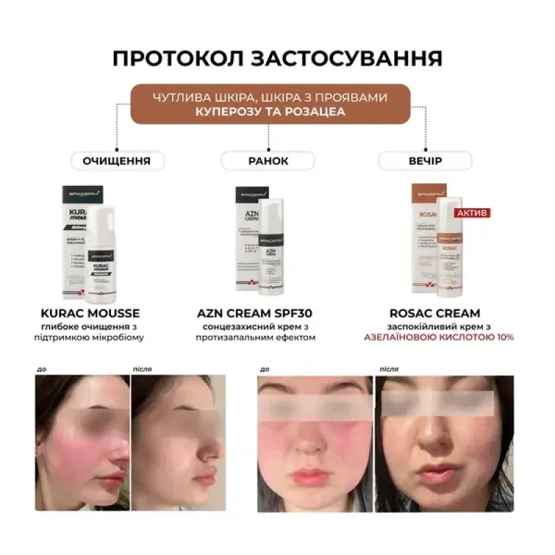 Заспокійливий крем BRADERM Rosac Cream, 30 мл