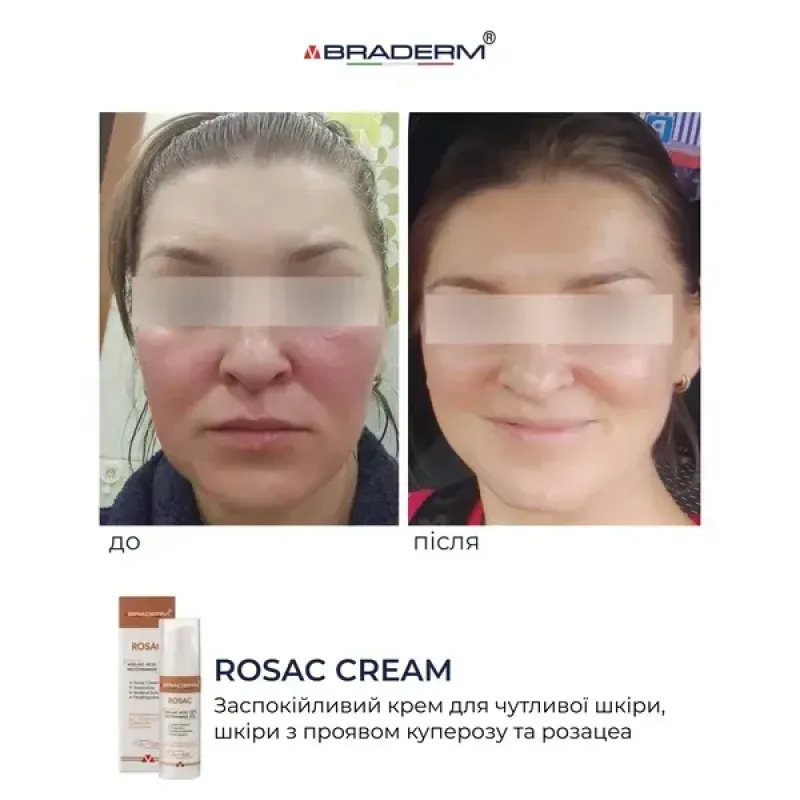 Заспокійливий крем BRADERM Rosac Cream, 30 мл