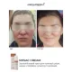 Заспокійливий крем BRADERM Rosac Cream, 30 мл
