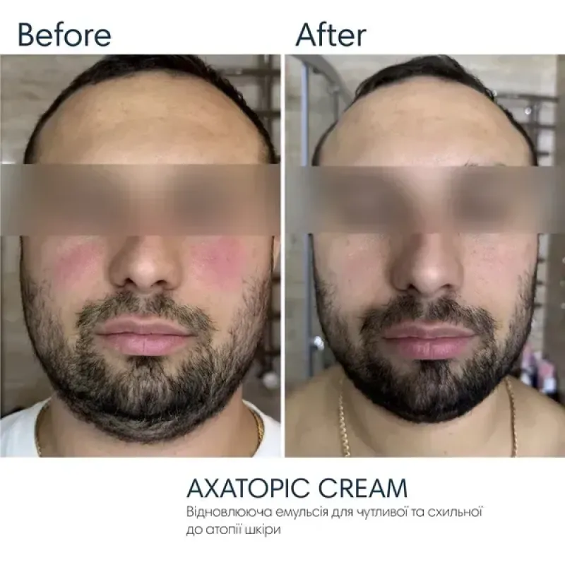 Зволожувальна емульсія BRADERM Axatopic Cream, 250 мл