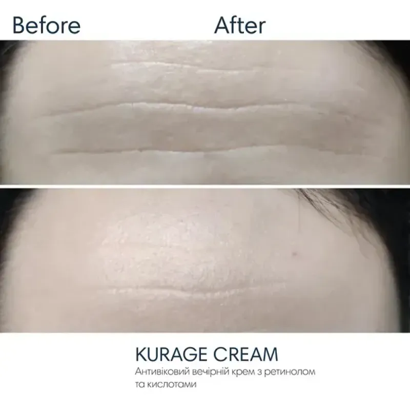 Антивіковий вечірній крем-пілінг BRADERM Kurage Cream, 30 мл