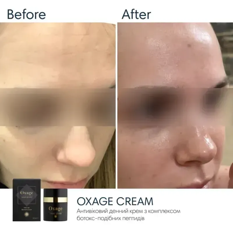 Антивіковий денний крем SPF30 BRADERM Oxage Cream, 30 мл
