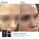 Антивіковий денний крем SPF30 BRADERM Oxage Cream, 30 мл