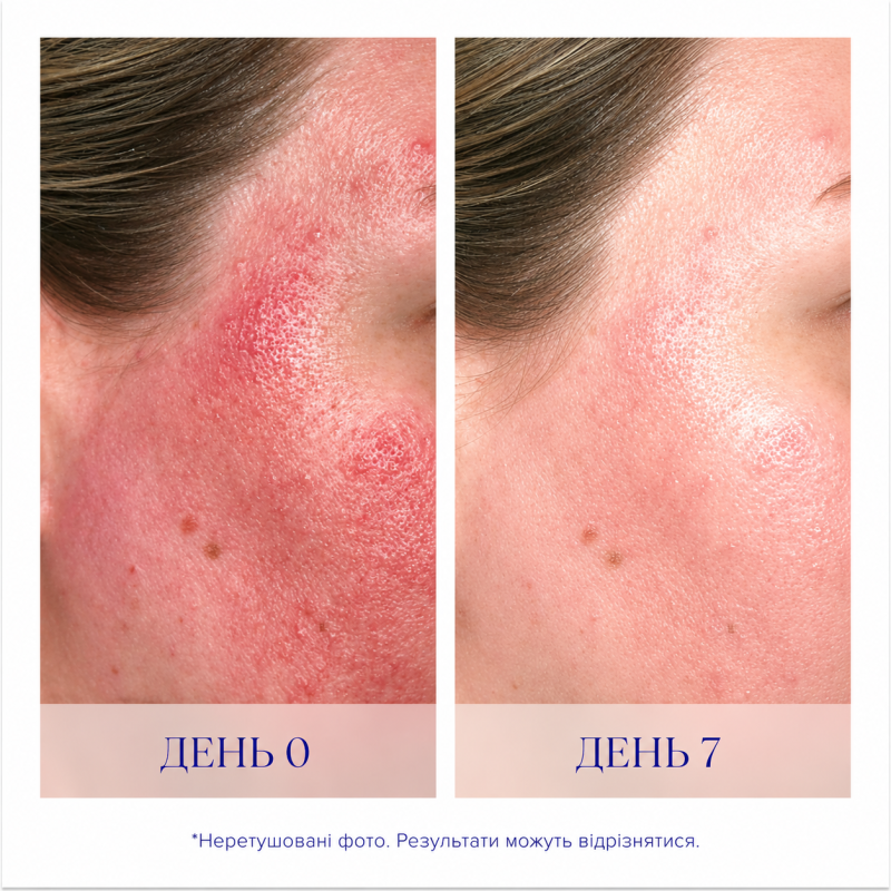 Сироватка для загоєння IS Clinical Pro-Heal Serum Advance 30ml