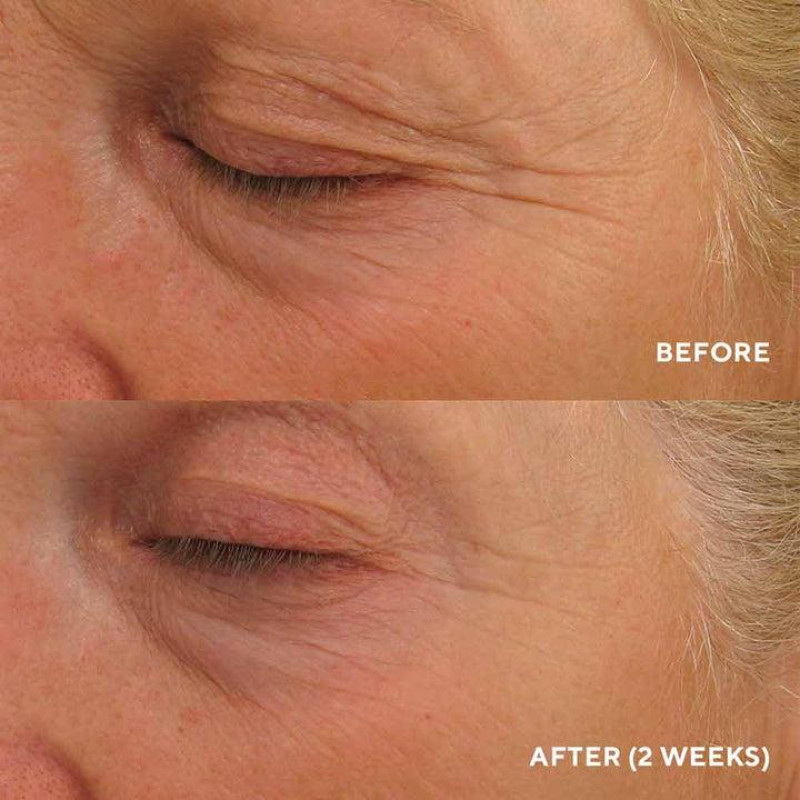 Інтенсивний ліфтинг-крем для повік HydroPeptide Eye Authority 15 мл