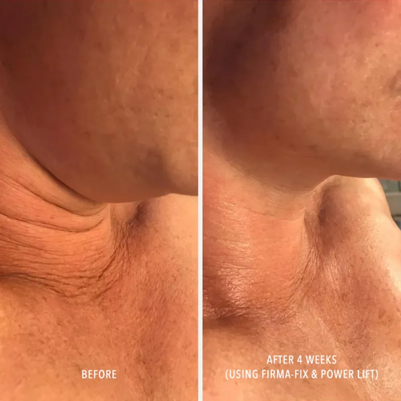 Ліфтинг-сироватка для шиї та декольте Hydropeptide Firm-A-Fix Nectar, 50 мл