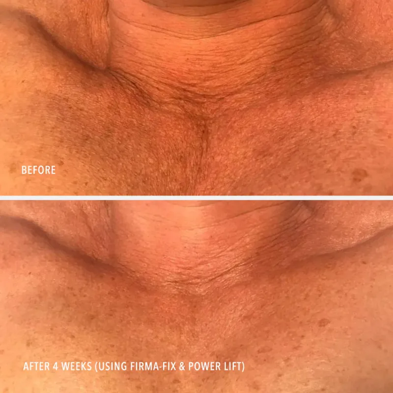 Ліфтинг-сироватка для шиї та декольте Hydropeptide Firm-A-Fix Nectar, 50 мл