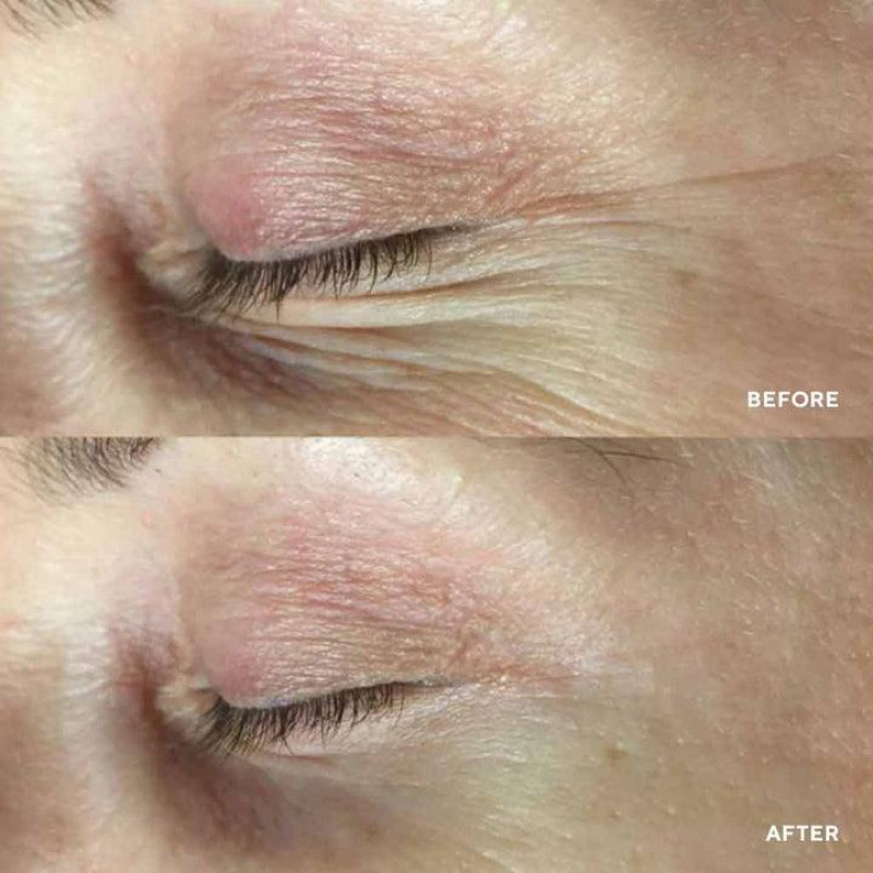 Патчі для зони навколо очей HydroPeptide PolyPeptide Collagel + Mask for eyes