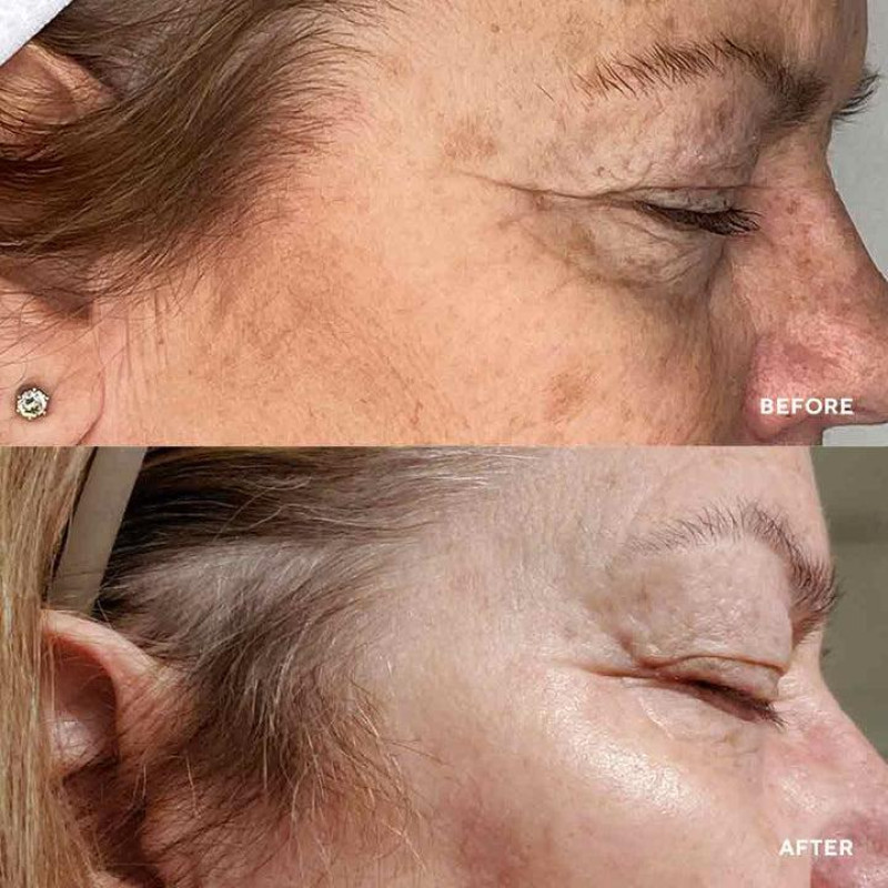 Сироватка з миттєвою anti-age дією HydroPeptide Vital Eyes 15 мл