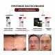 Освітлювальний крем BRADERM Tramexal Cream, 30 мл