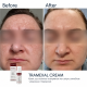 Освітлювальний крем BRADERM Tramexal Cream, 30 мл