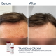 Освітлювальний крем BRADERM Tramexal Cream, 30 мл