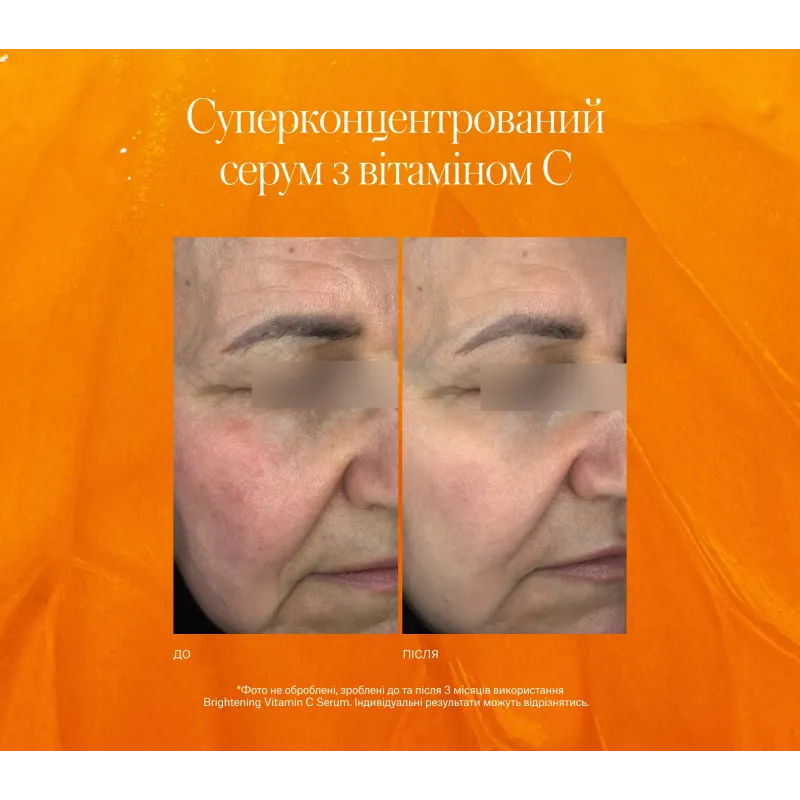 Сироватка INSTYTUTUM Brightening Vitamin C Serum Next-Gen