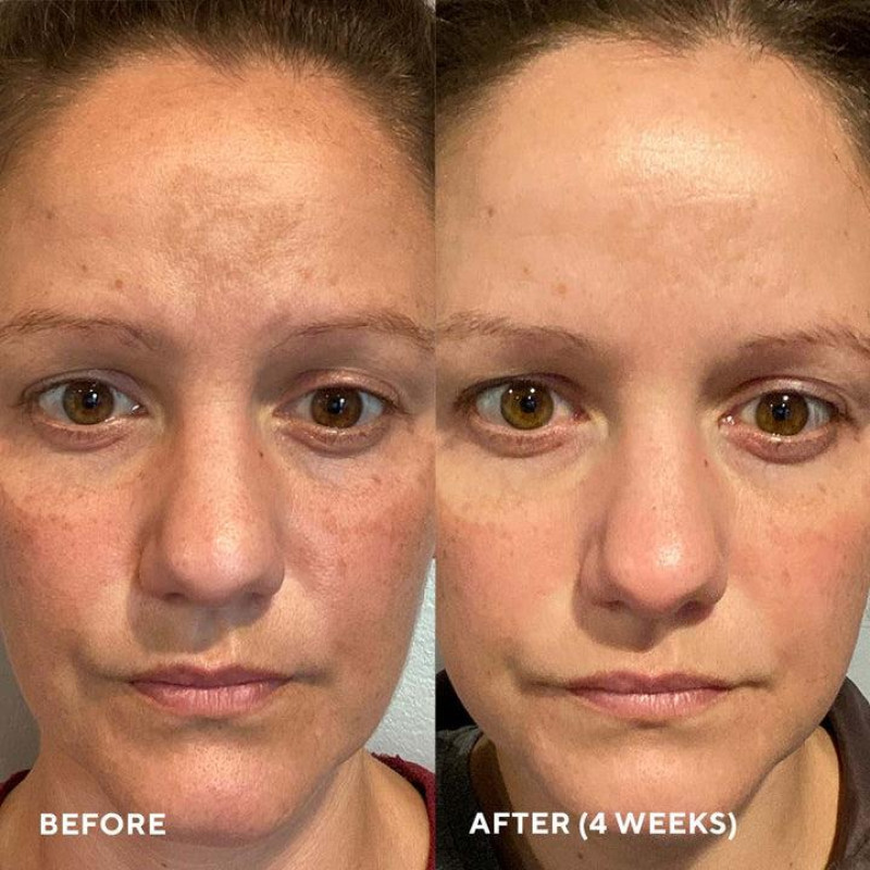 HydroPeptide Firma-Bright – Зміцнюючий засіб для сяяння, освітлення і захисту шкіри 30ml