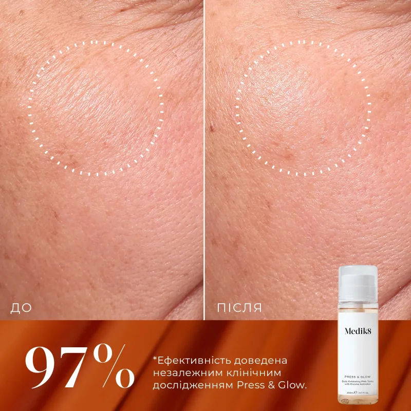 Набор для мгновенного сияния и разглаживания кожи Medik8 Luminous Lift 200 мл + 30 мл