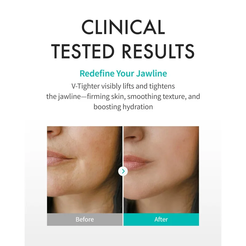 Восстанавливающая V-лифтинг маска REJURAN Perfect Healing V Tighter, 4 шт