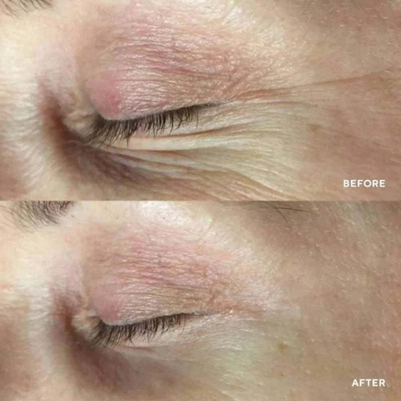 Патчи для зоны вокруг глаз HydroPeptide PolyPeptide Collagel + Mask for eyes