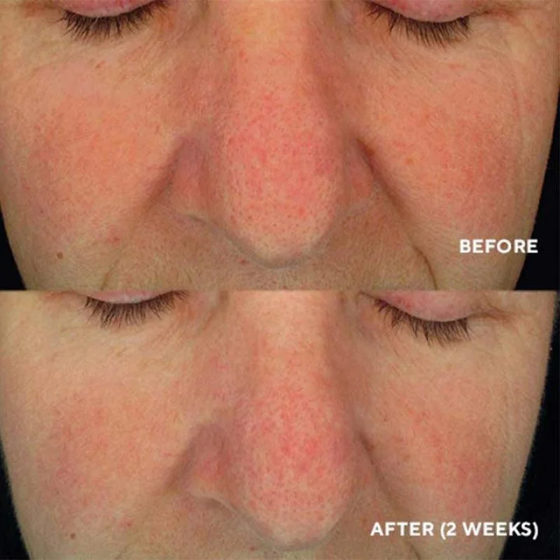 HydroPeptide Soothing Serum – Заспокійлива сироватка 30ml