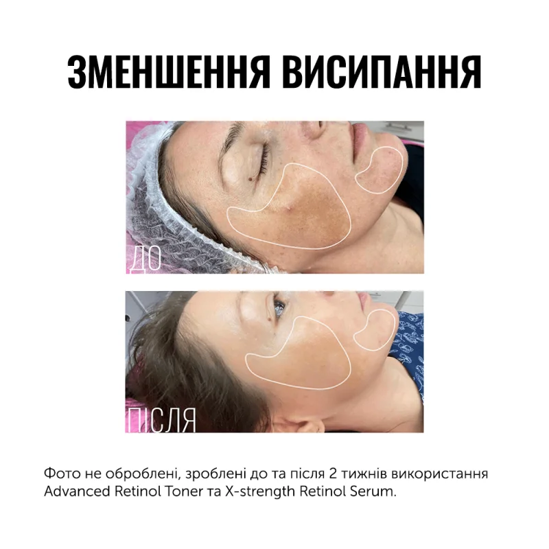 Travel-size тонер с ретинолом Advanced Retinol Toner 50ml
