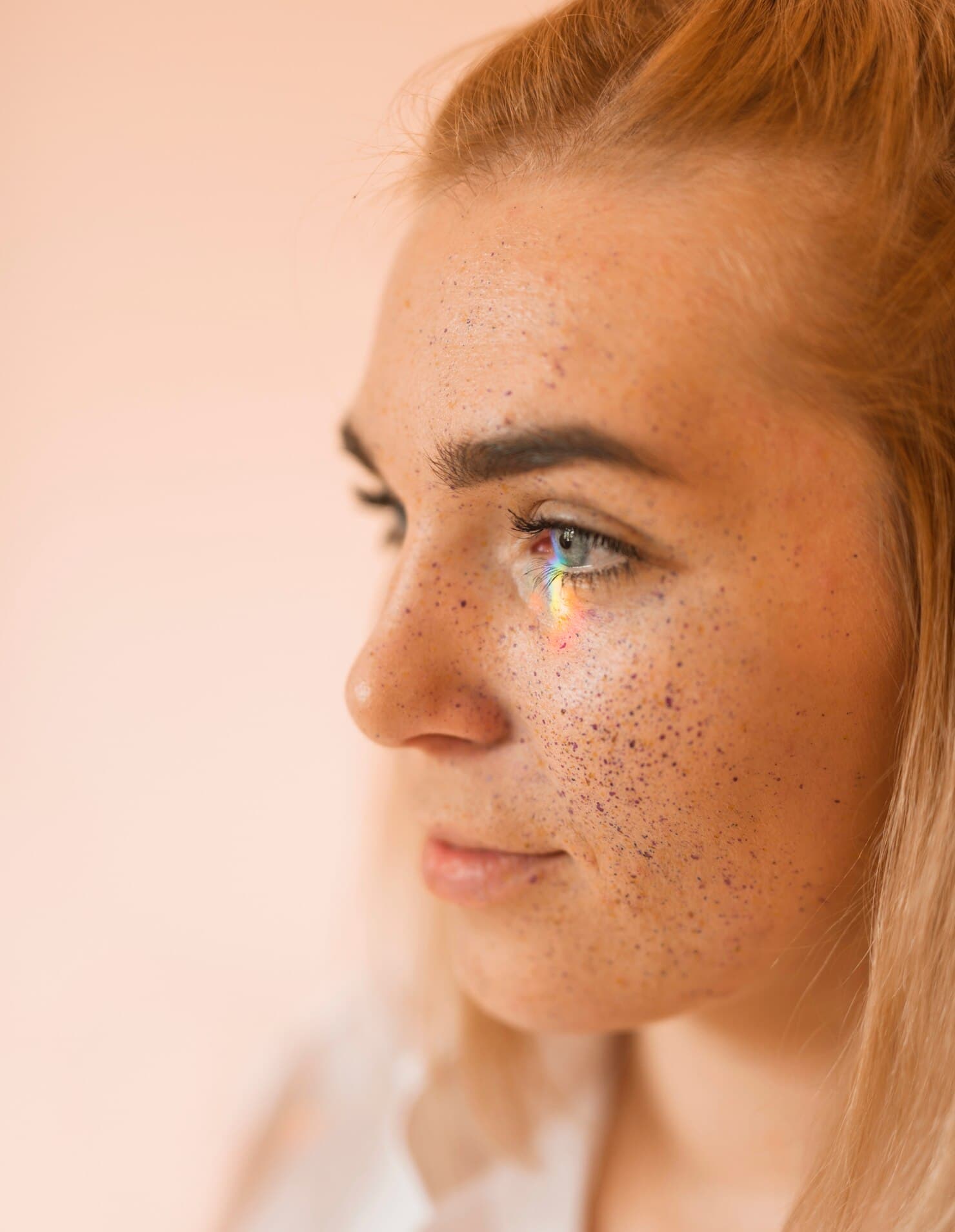 Комедоны на коже