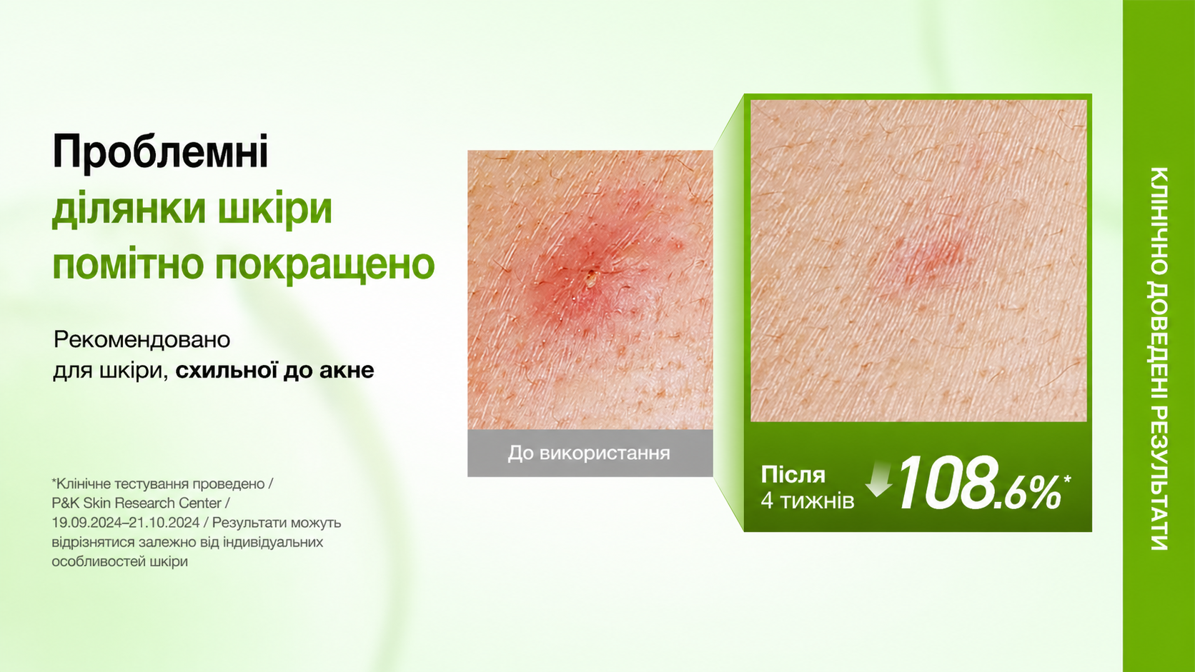 anua сироватка Azelaic 